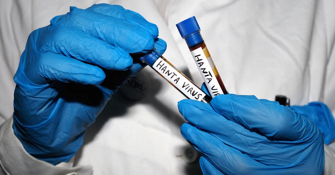 All Your Hantavirus Questions, Answered by an Infectious Disease Expert – WIRED