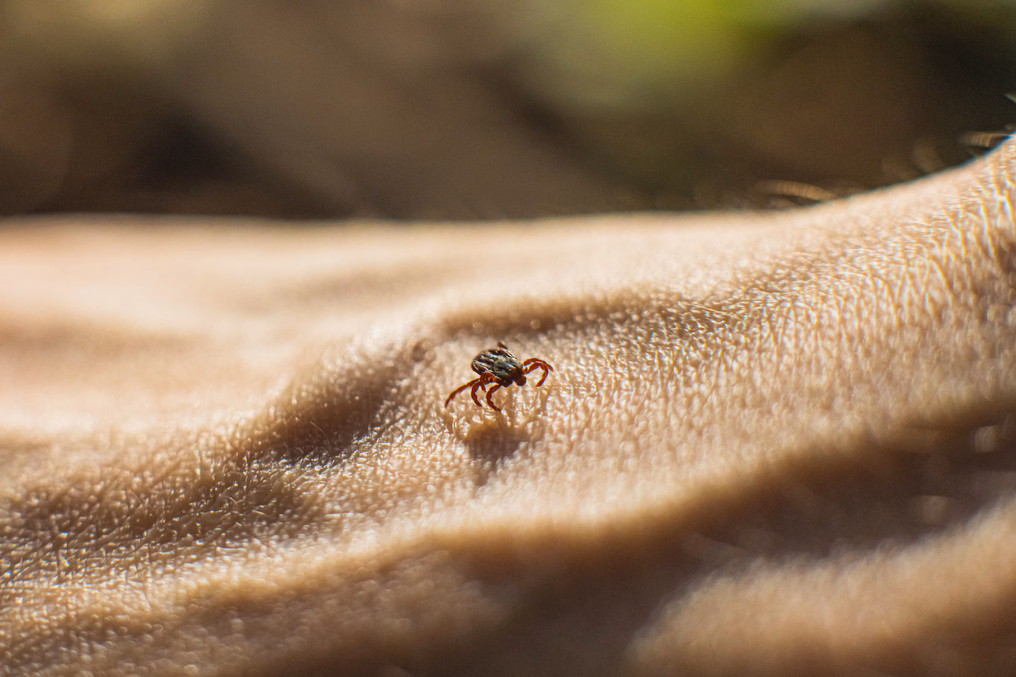 This rare tick-borne disease is on the rise in the U.S. – The Washington Post