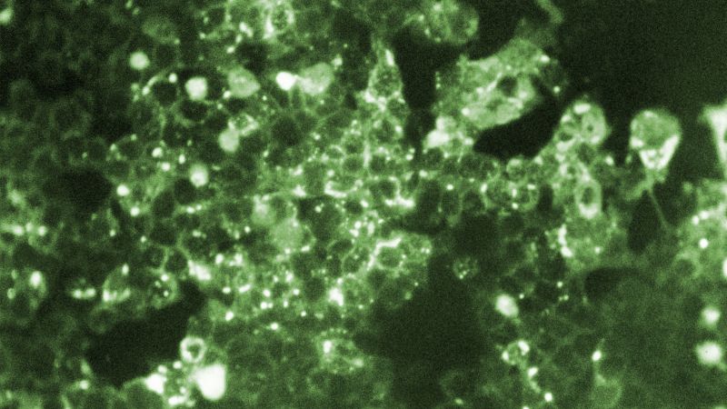 How common are measles deaths in the United States as vaccination rates fall? – CNN